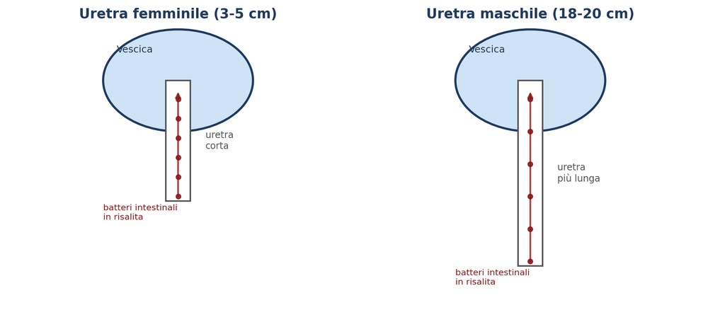 Confronto tra il percorso più breve dei batteri nell'uretra femminile e quello più lungo nell'uretra maschile